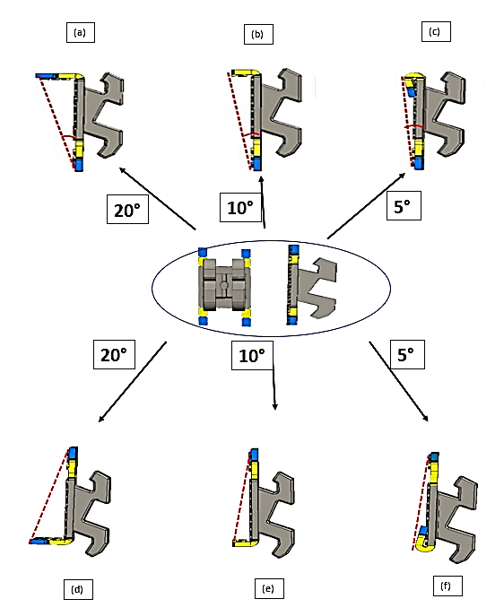 Six options of anterior torque