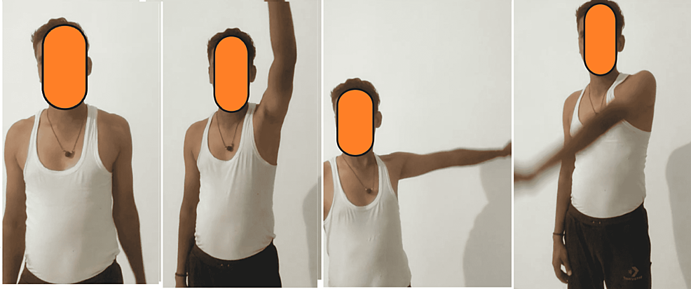 Post-operative range of movements after 3 months