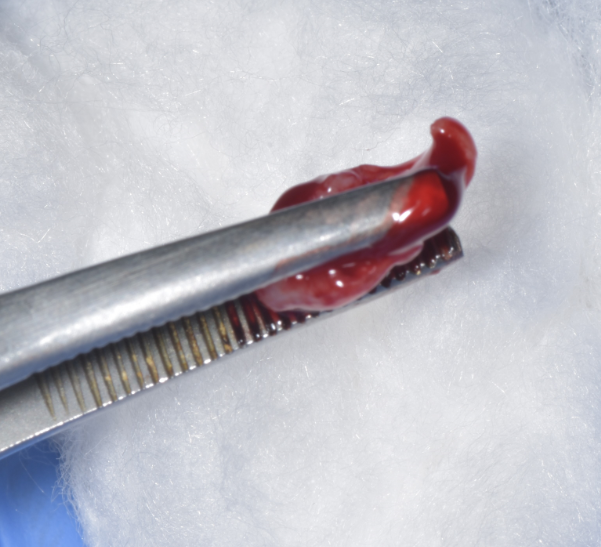 Excised tissue