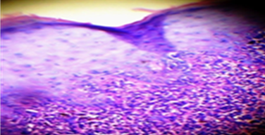 Histopathological section