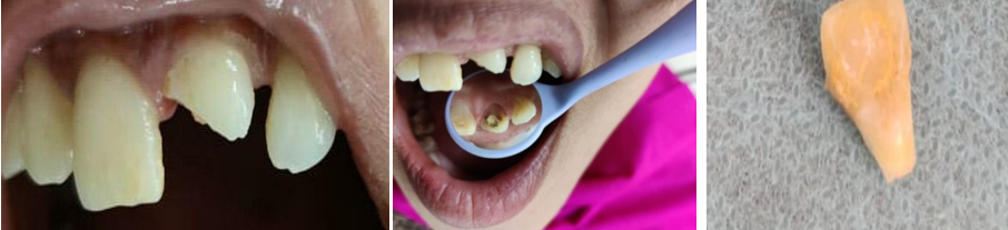 Preoperative images