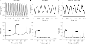 Segments-of0.25seconds of the initial-time-domain signals acquired as of saline-bath plus power-spectral-density, i.e., spectra of PSD of them.