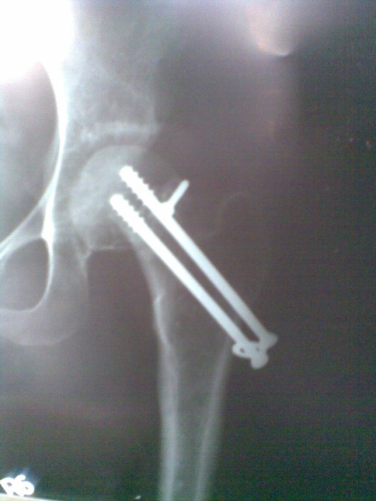 Case 3: Postoerative X-ray