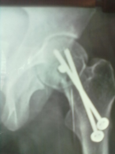Case 1: Postoperative at 20 weeks