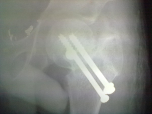 Case 2: Postoperative at 10 weeks