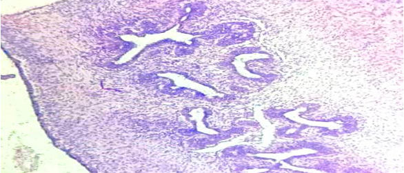 Sections of proliferative breast disease (H and E x10×).