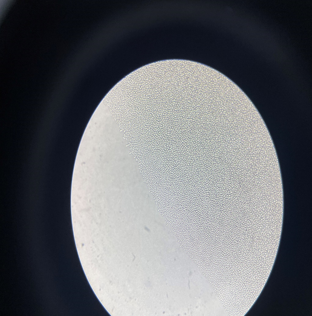 Corn meal agar showing Candida glabrata