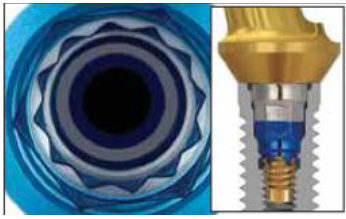 12 point internal connection