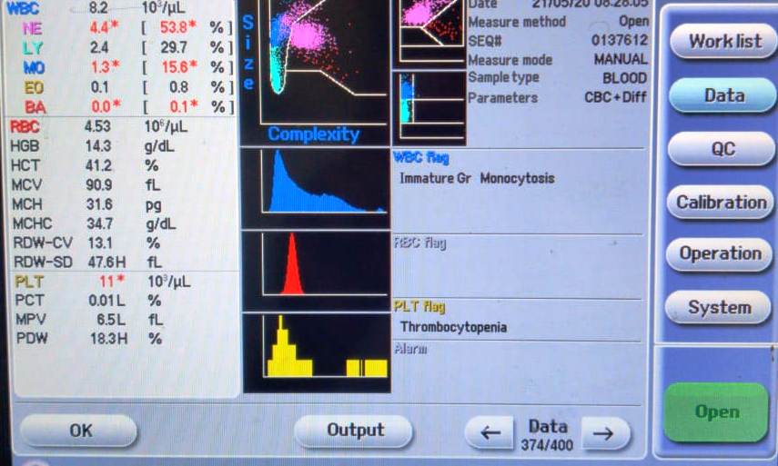 Normal histogram