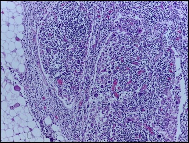Lymph node at 200X showing expanded sinuses