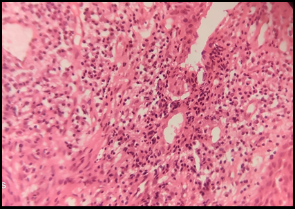Histopathology of the lesion