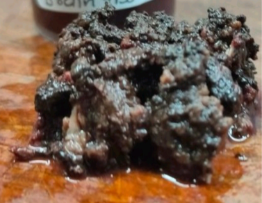 Gross examination 