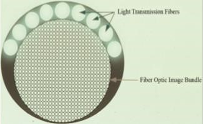 Fibers of Orascope