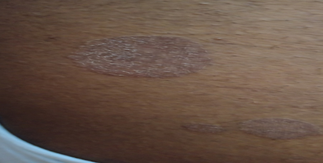  Plaque type of chromic PV