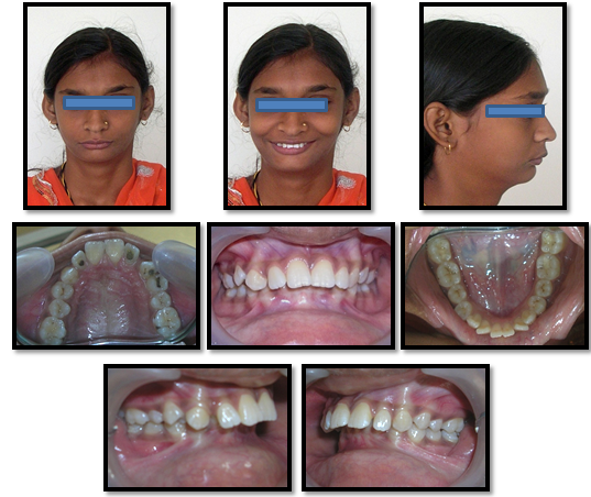 Pre-treatment photographs