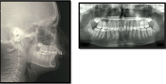 Pre-treatment radiographs