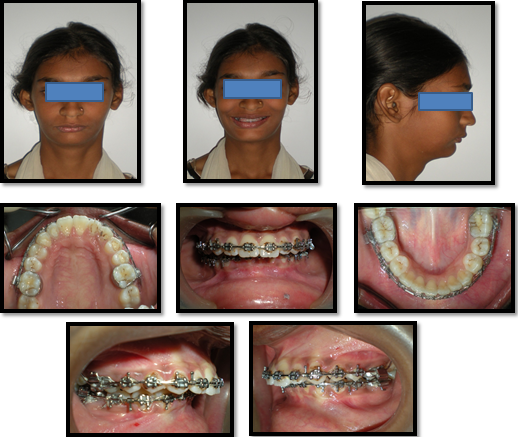 Pre-surgical photographs