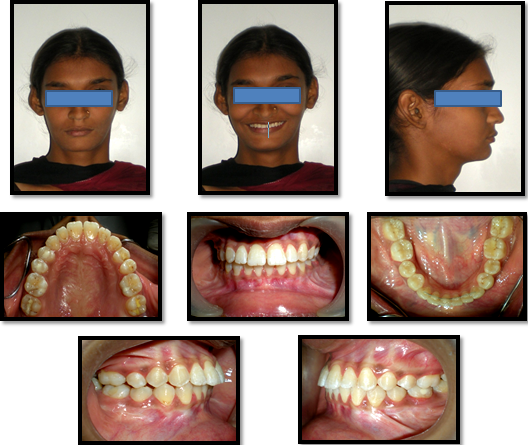 Post-treatment photographs