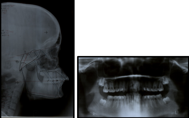 Pre treatment radiographs