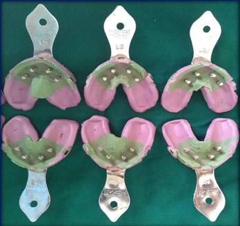 PVS impressions with attached implant analog