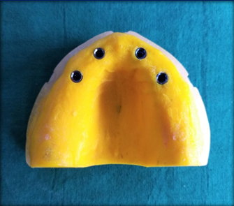 Master model1