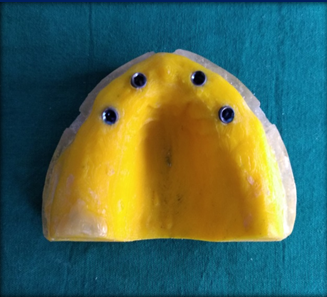 Master model 2