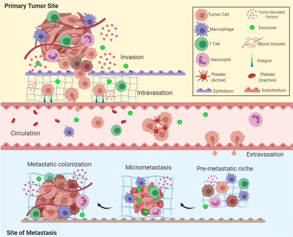 Overview of the metastatic cascade: The five key steps of metastasis include invasion,intravasation, circulation, extravasation, and colonization24