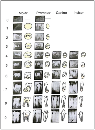 Dental age of each subjects according to developmental stages of left eight mandibular permanent teeth using modified demirjian’s method.