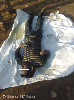 Showing dead body as retrieved.