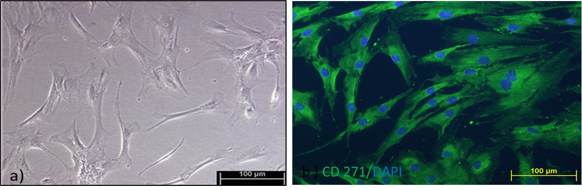 Phenotypic confirmation MSCs isolated from ACL. a) P3-cells under light microscope (20X). b)Immunostaining for MSC marker, CD271 and nuclear stain, DAPI of the isolated P3-MSCs (20X). Results are shown as representative of triplicates.