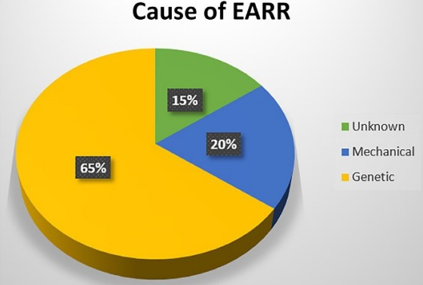Causes ofexternal apical root resorption