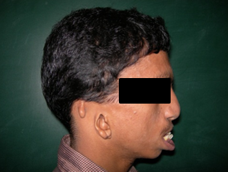 Pre op lateral view