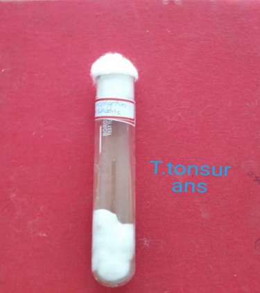 T. tonsurans on SDA