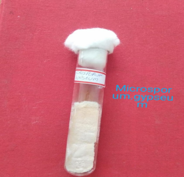 Microsporum gypseum on SDA