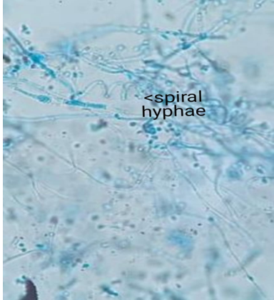 LPCB mount showing spiral hyphae