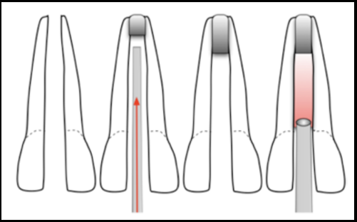 Compaction of MTA