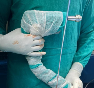 Drill draped in drapes and secured with an autoclaved cotton bandage.