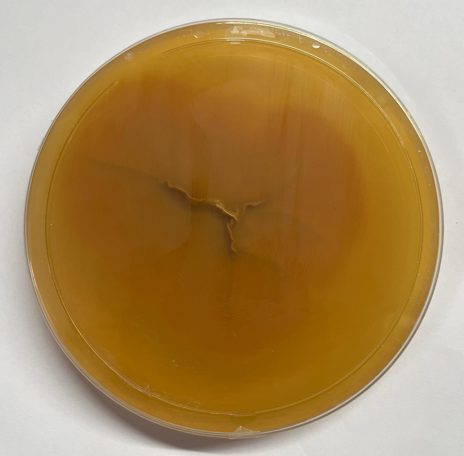 Revese view of aspergillus nidulans on sabouraud dextrose agar