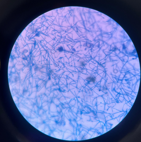 Microscopic image of aspergillus nidulans under light microscopy using lactophenol cotton blur (LPCB)