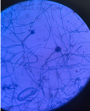LPCB mount of aspergillus nidulans 40X