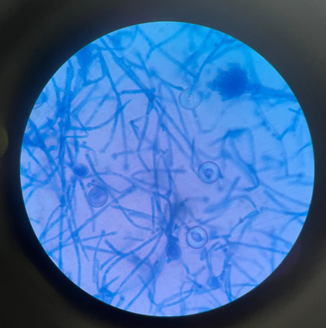 LPCB mount of aspergillus nidulans shows hulle cell