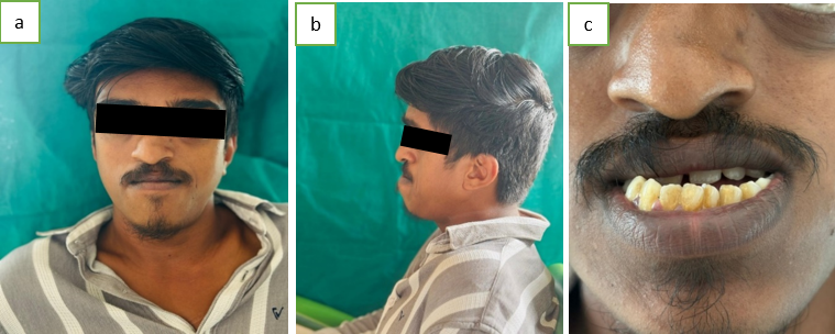 a,b,c 