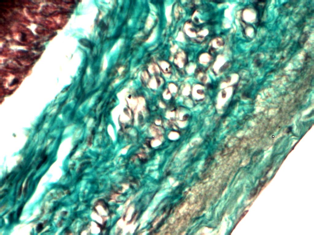 Section of apex showing cells beneathepicardium