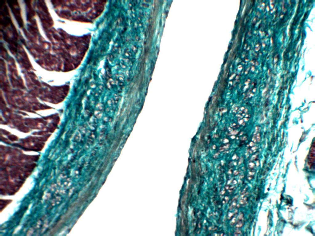 Section of apex showing proximity ofepicardium & endocardium