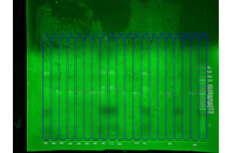  Agarose gel electrophoresis