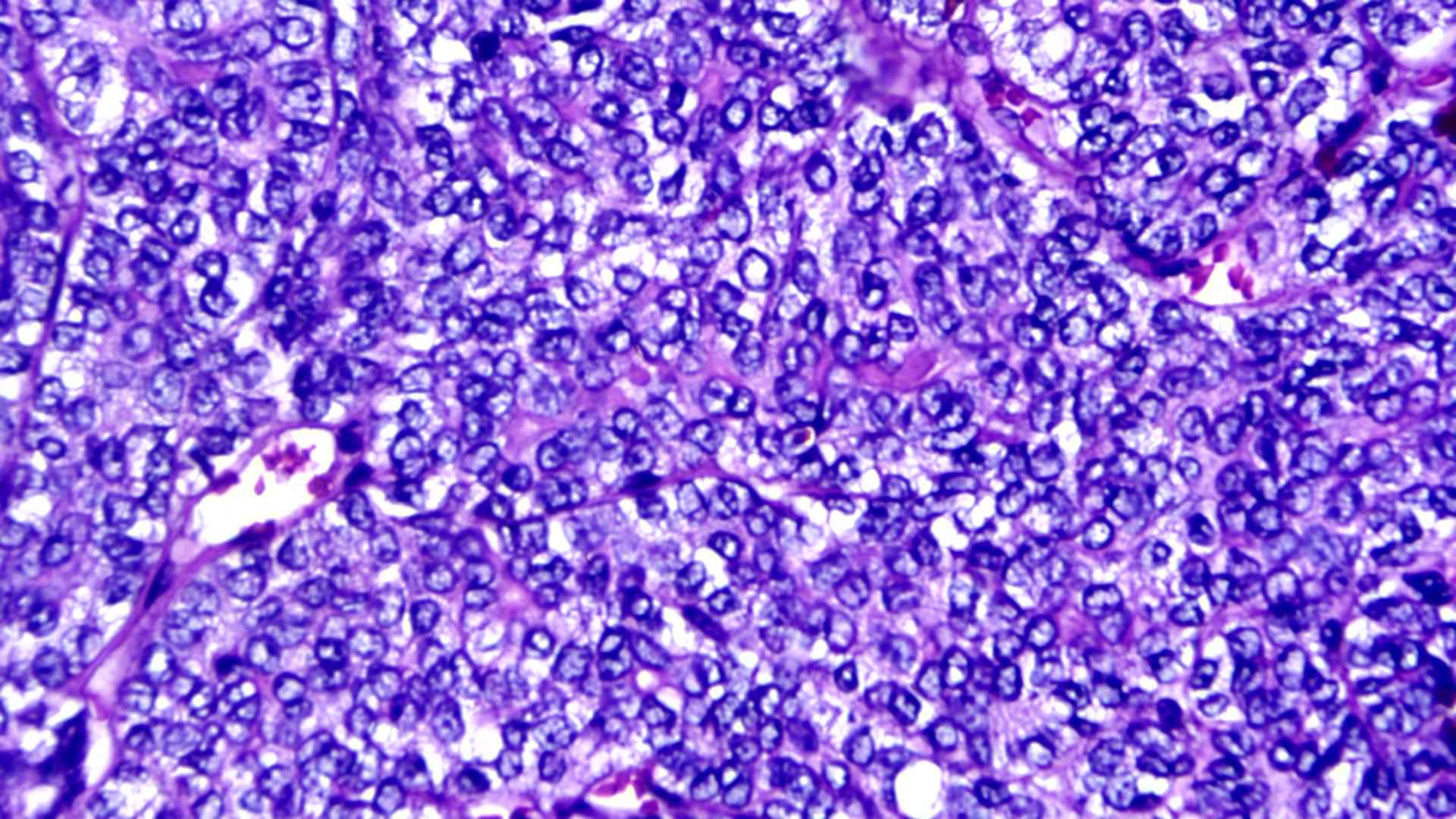 Clear cells in high power