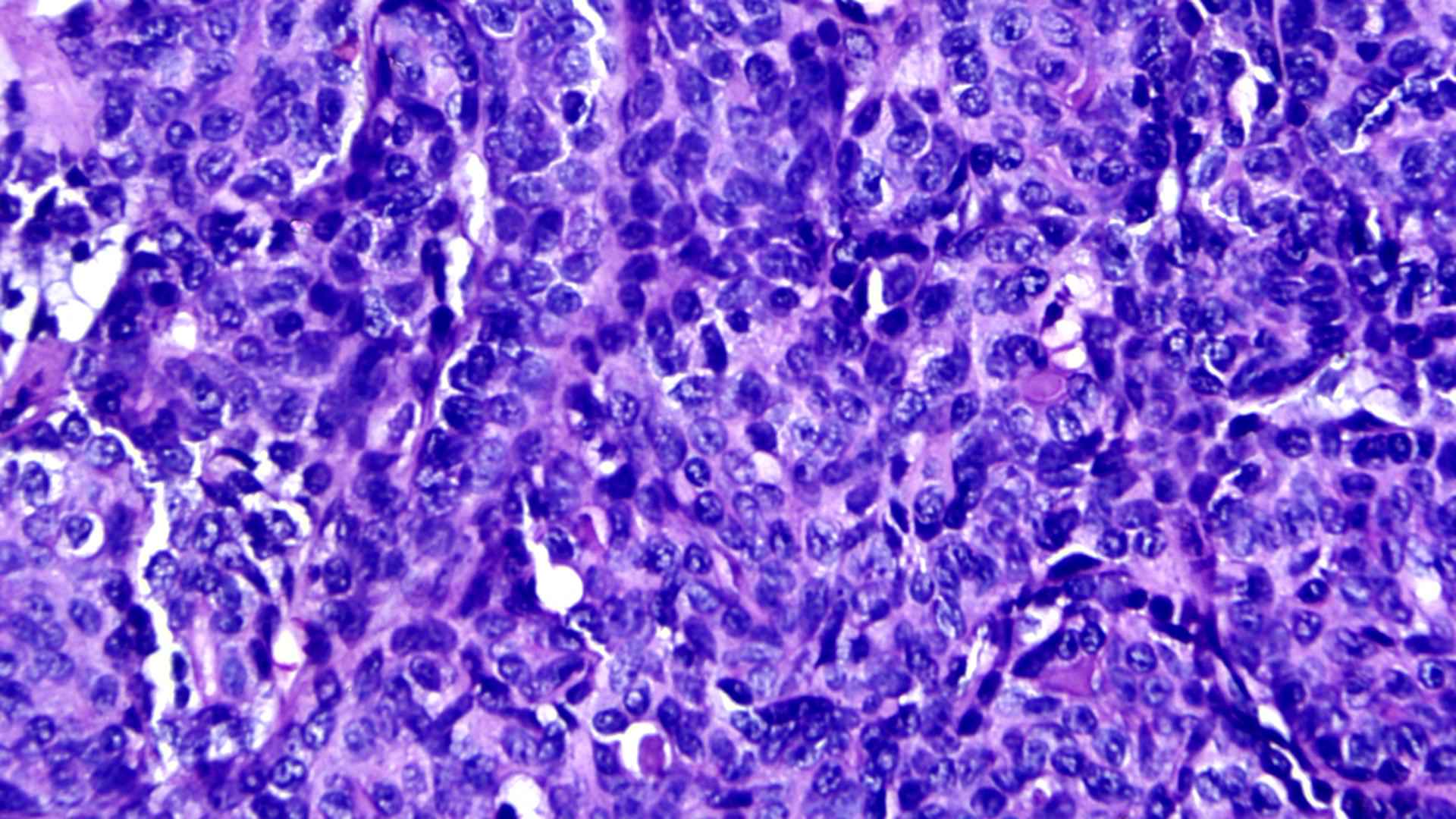 Dual cell population