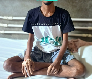 Patient with aspergillus bone marrow infection