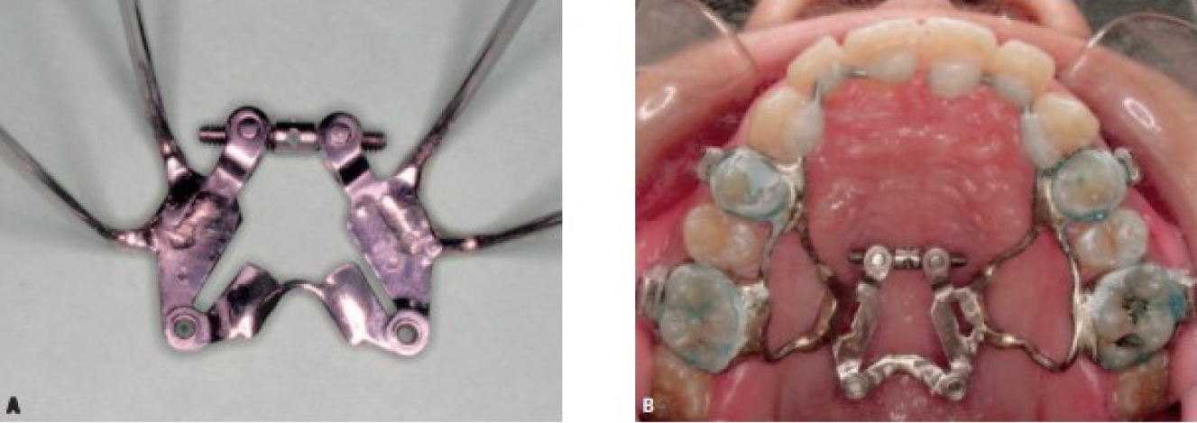 Double hinged expander