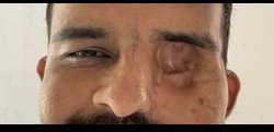 Image showing defect region